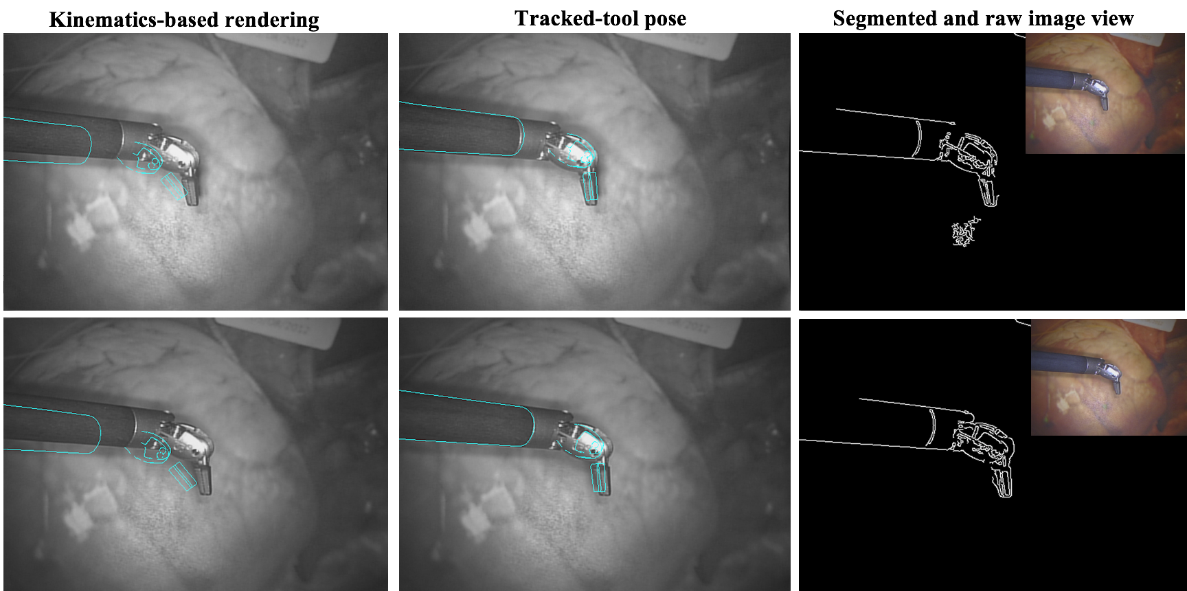 VisionBased Surgical Tool Tracking Ran Hao